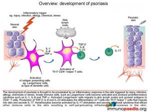 development of psoriasis