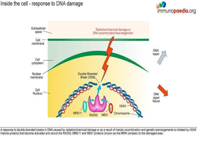 Ataxia-telangiectasia Case Study | Immunopaedia