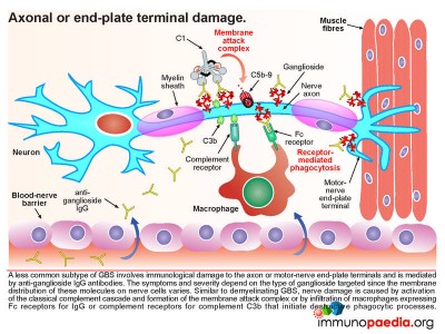 axonal-or-End-Plate-Terminal-Damage | Immunopaedia