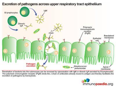 Streptococcal pneumoniae meningitis Case Study | Immunopaedia