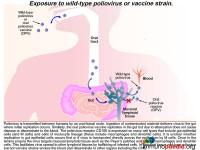 Vaccine Associated Paralytic Polio Case Study | Immunopaedia