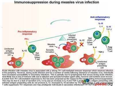 Subacute Measles Encephalitis Case Study | Immunopaedia