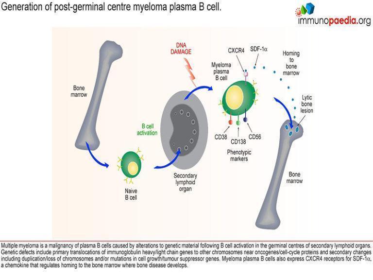 multiple myeloma case study