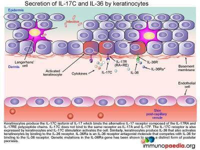 Severe Psoriasis vulgaris Case Study | Immunopaedia