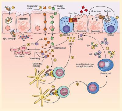 T cell mediated autoimmune diseases | Immunopaedia