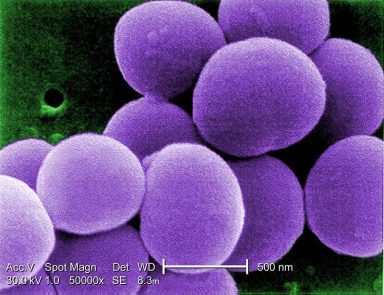 Gut Microbiota Influences Pathogenesis Of Parkinson’s Disease 