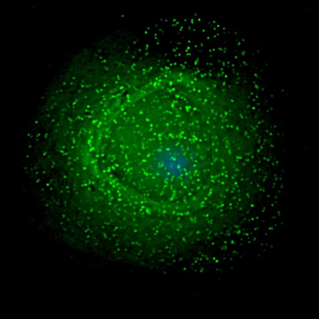 Conventional antibody can neutralize HIV Immunopaedia