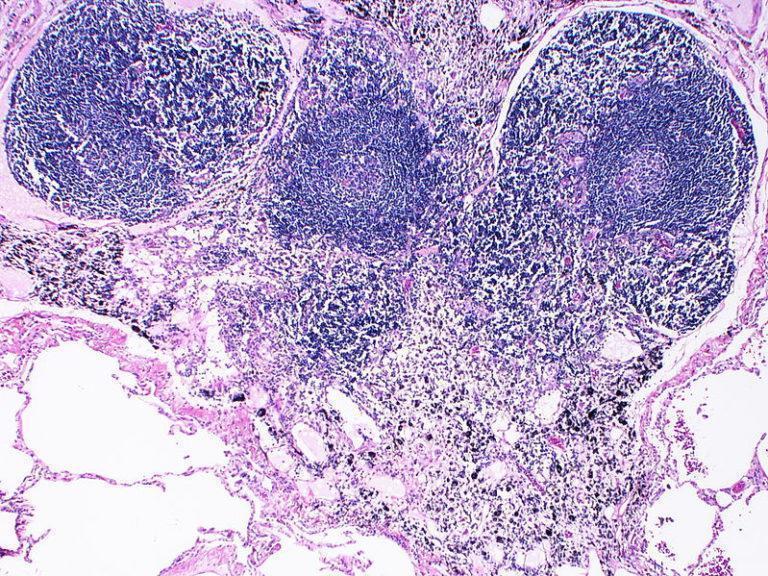 Using Chemokine Cxcl13 As A Biomarker Of Germinal Centre Activity 