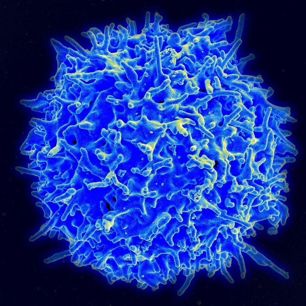 reprogrammed-t-cells-to-treat-cancer-immunopaedia