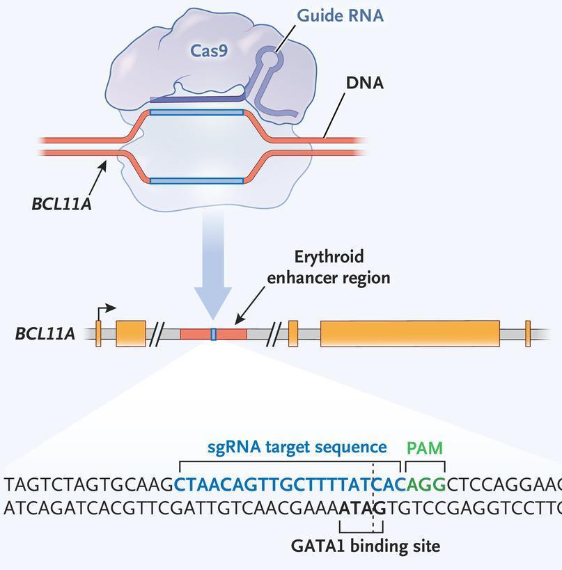 Gene editing as a potential sickle cell disease immunotherapy ...